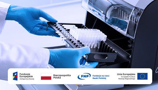 Projekt FNP: Team-Tech - test umożliwiający określenie ryzyka utraty przeszczepionej nerki